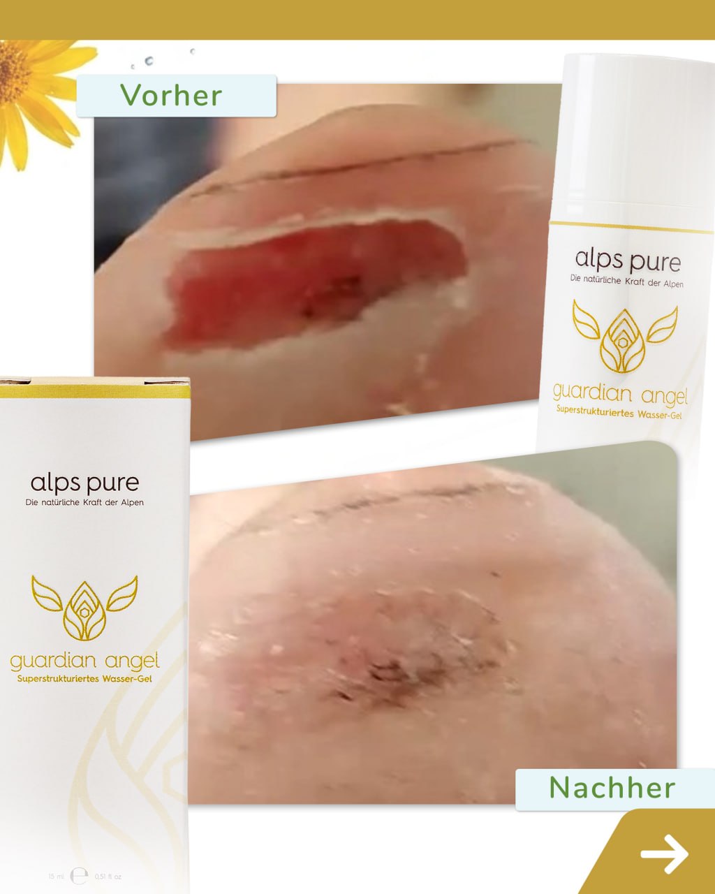 guardian angel – Vorher / Nachher Wunde